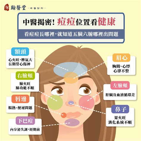 眉毛 痘痘|眉毛、人中長痘痘的原因？10個「青春痘位置」對應你。